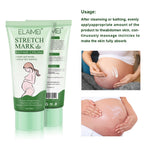 Stretch Mark Repair Cream Smooth Tender Enhance Skin Elastictiy Acne Repair 60ml Anti-Aging Cream Pregnancy Scars
